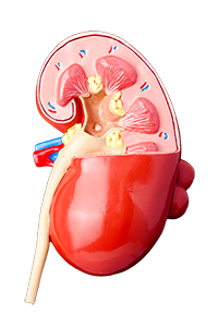 WHAT HAPPENS IF OUR KIDNEY HEALTH DETERIORATES?